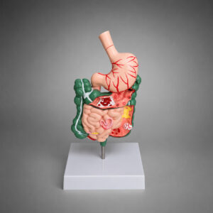 Modelo Anatômico do Sistema Digestivo com Patologias, com estômago seccionável